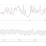 HRV Before and after (3) (1)